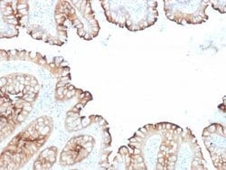 Villin 1 Mouse anti-Human, Clone: VIL1/1314 + VIL1/2376, Novus Biologicals